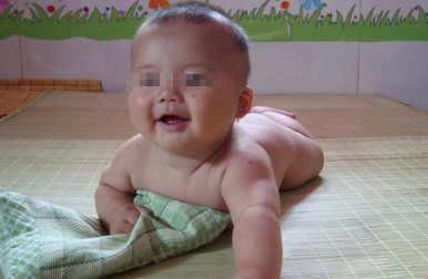 2岁男童少了一个蛋蛋，宝妈惊慌不知所措