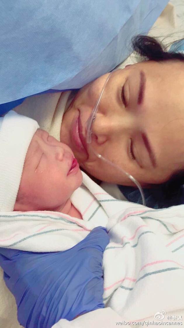 伊能静产后怎么养,伊能静二胎刀口裂开了吗