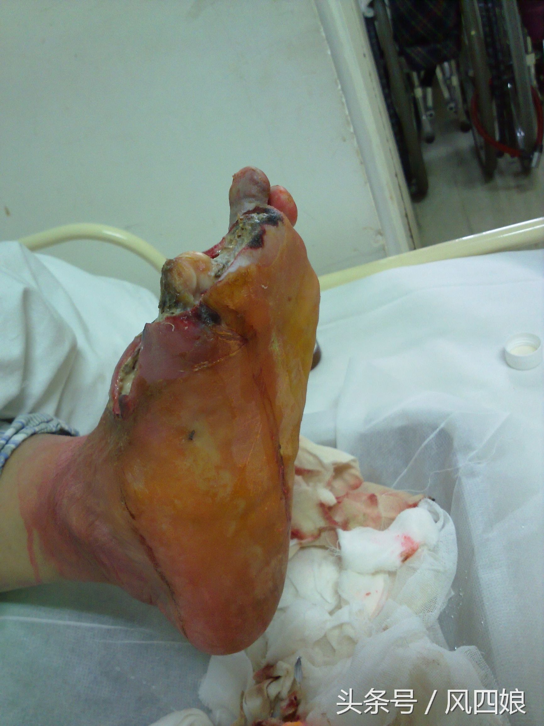 九旬老人摔倒后扶不扶,九旬老人摔倒卧床