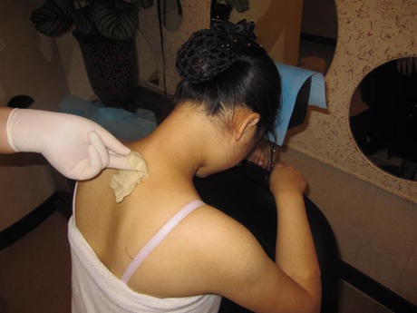 竹罐儿御医的非遗传承之路