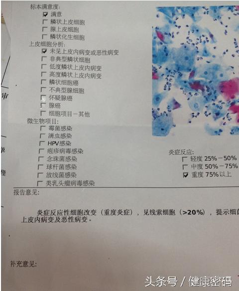 子宫检查报告单如何看,妇科子宫颈刮片是怎么检查的