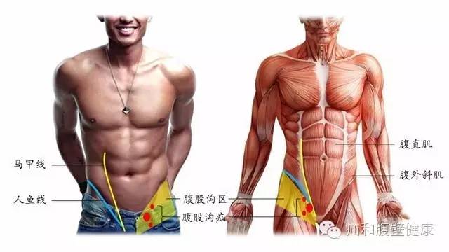 腹股沟疝气是不是只有一个睾丸,腹股沟疝气双侧9mm