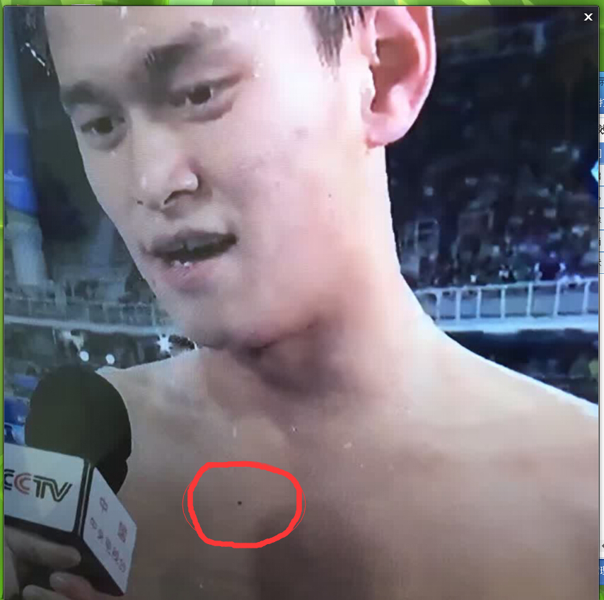 奥运会中那些面相+痣的分类代表了什么含义？冠军or脑残！