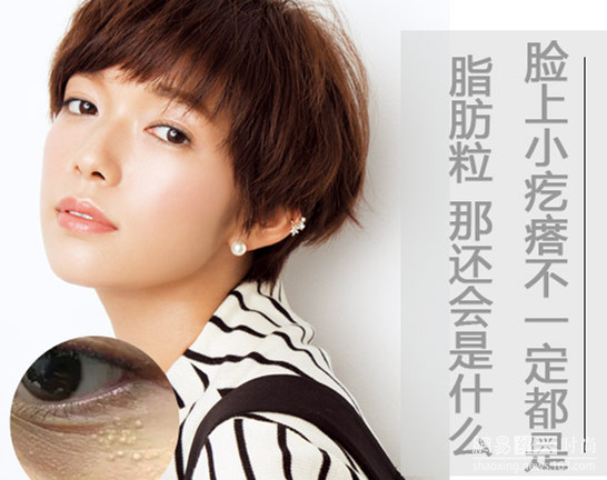 眼睛周围的扁平疣怎么消除脂肪粒,眼睛周围有脂肪粒是胆固醇高吗