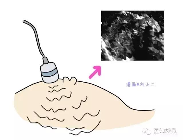 深度解析：普通B超、三维及四维彩超的区别