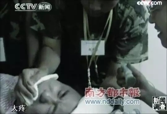 小孩被电击了要治疗吗,电击是对人体的什么伤害