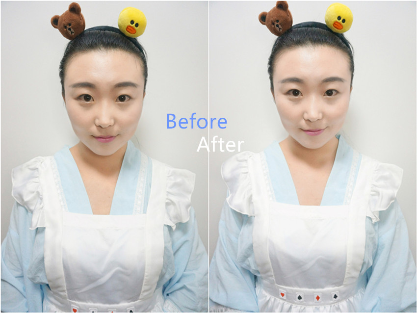 自然堂蓝瓶补水保湿水乳,适合油肌肤夏天用的自然堂冰肌水