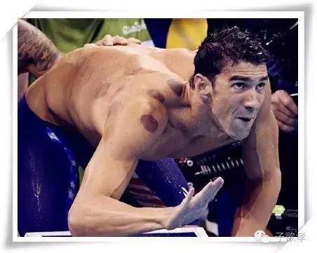 里约奥运会开幕式点燃火炬,里约奥运会拔火罐