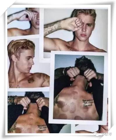 里约奥运会开幕式点燃火炬,里约奥运会拔火罐