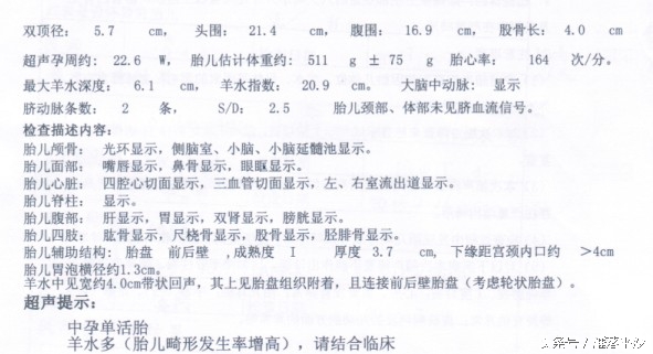 孕期羊水多对胎儿有危险吗,孕33周羊水过多胎儿畸形概率