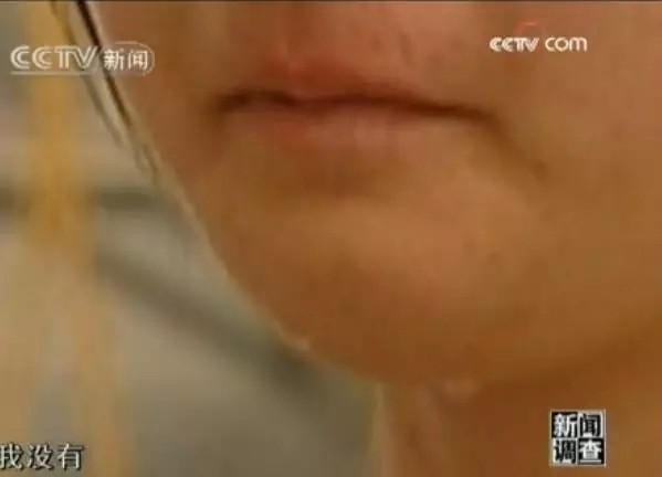 小孩被电击了要治疗吗,电击是对人体的什么伤害