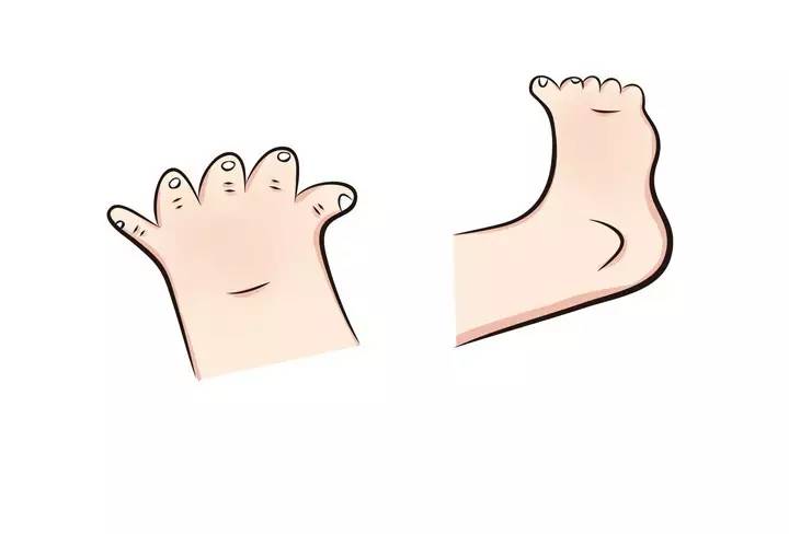 啊呜，宝宝手指被夹了