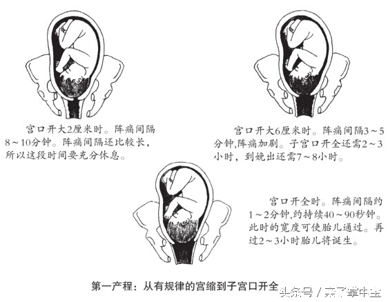 产妇关注了！分娩时生的太快，对新生儿有害！