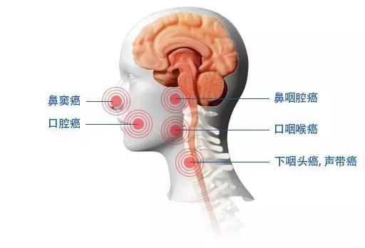 韩国三星医院治疗费用,首尔癌症医院