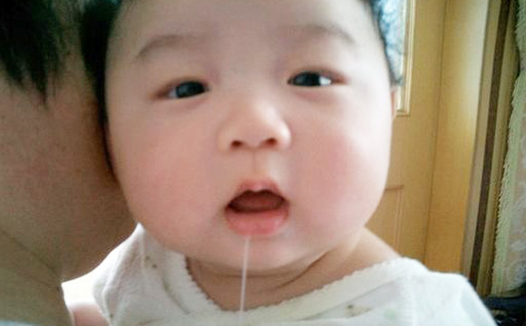 成年人会不经意间流口水,成年人感觉嘴角流口水