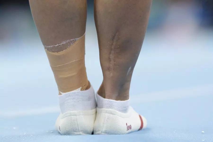 看看丘妈的伤口，跟腱断裂到底是什么？