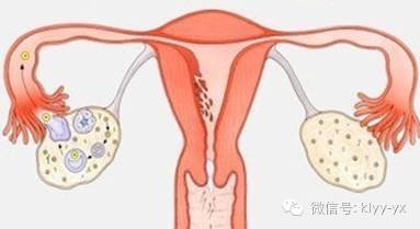孕期出血有哪些危险,孕期阴道出血的症状