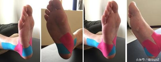 脚踝扭伤了不能走路怎么恢复最快,脚踝扭伤影响运动功能吗
