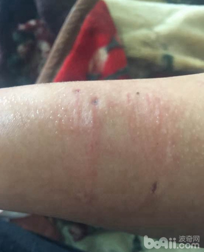 二哈狗爪子被咬了,二哈被小狗咬伤