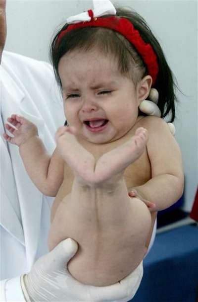 美人鱼生了个没有尾巴的宝宝,生宝宝的美人鱼娃娃