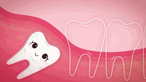 一吃东西就塞牙有什么好办法,怎样防止食物塞牙