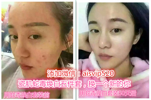 瓷肌祛黄效果怎么样,瓷肌白祛斑怎么样