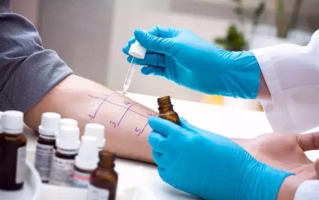 输液需要皮试的有哪些,输液做皮试是什么意思