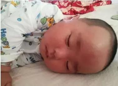 手皮肤褶皱脱皮用什么药膏好呢,眼皮痒红肿脱皮起褶皱怎么治疗