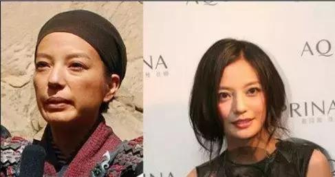 毛孔粗大怎么消除,毛孔粗大怎么消除最有效