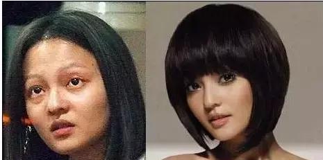 毛孔粗大怎么消除,毛孔粗大怎么消除最有效