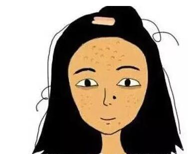 痘痘肌需知的小常识,痘痘肌避免哪些护肤误区