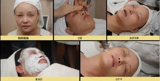 名医专访,专家医生谈敏感肌肤