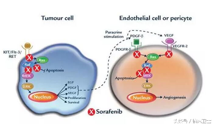 弥漫性肝癌肝衰竭可以化疗吗,晚期肝癌插管治疗