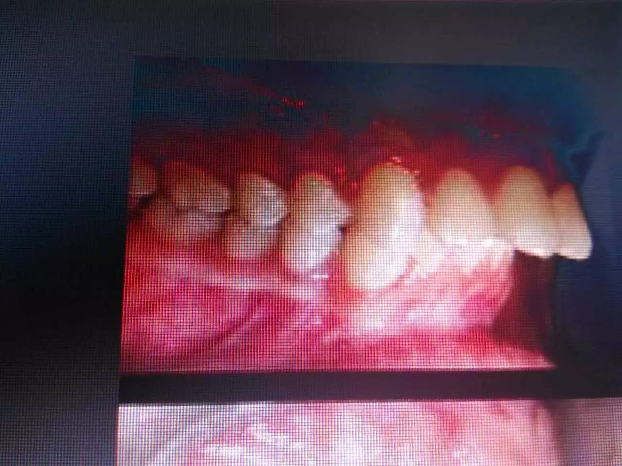 讲解换牙视频,换牙科普知识幼儿园