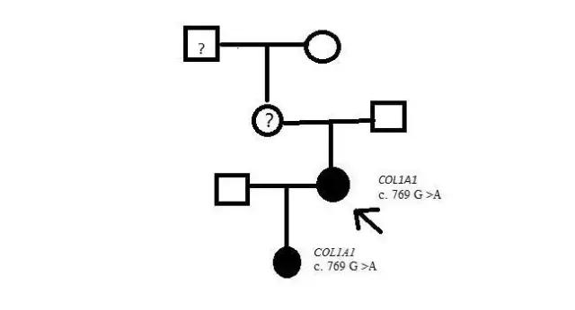瓷娃娃为爱生子,瓷娃娃护蓝光