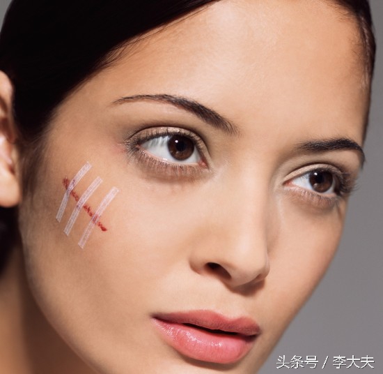 皮肤伤口增生,皮肤伤口愈合后反复长角质