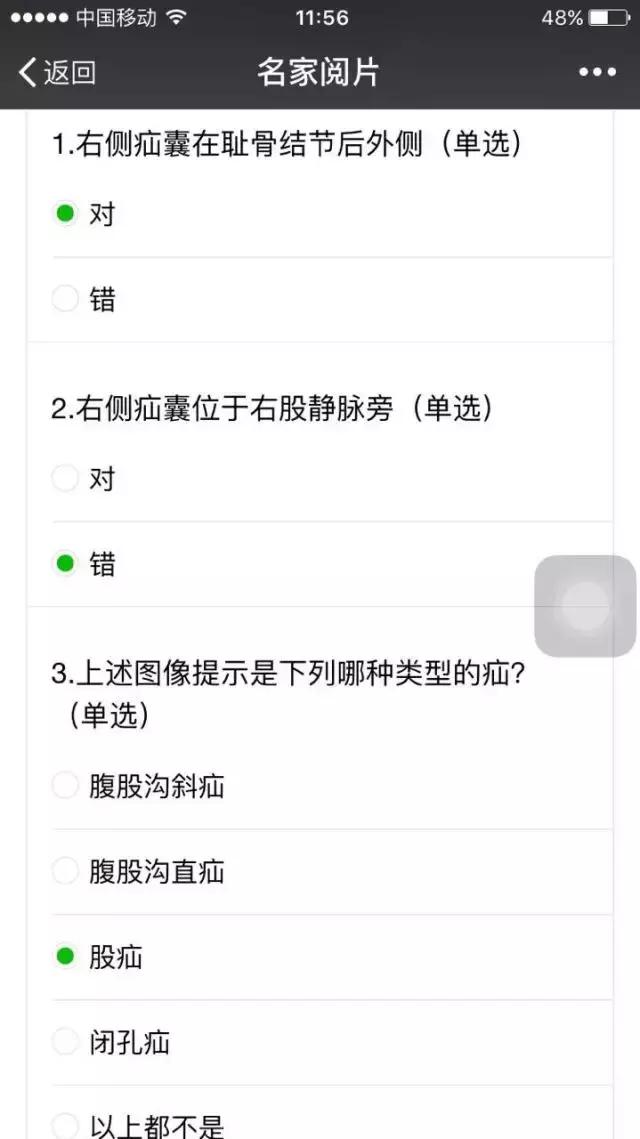 名医讲座腹股沟疝,医学专家谈腹股沟疝