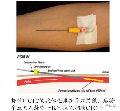 循环肿瘤细胞ctc检测技术,液体活检ctc多少费用