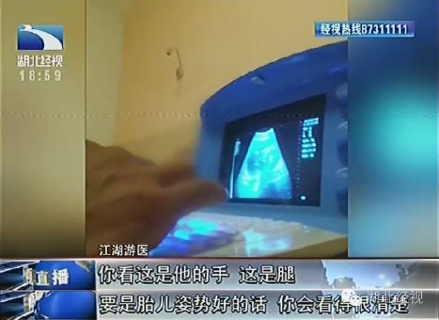 武汉胚胎送检哪些医院可以做,武汉检测怀孕的医院