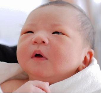 新生儿面部奶癣湿疹用什么药膏,婴儿湿疹奶癣用什么擦能好