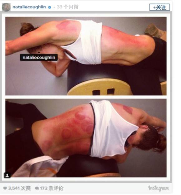 云健康丨一场奥运会，火了东方神秘的大中医