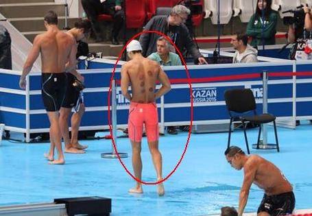 云健康丨一场奥运会，火了东方神秘的大中医