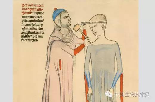 满清十大酷刑已逝，医疗九大“酷刑“还在沿用