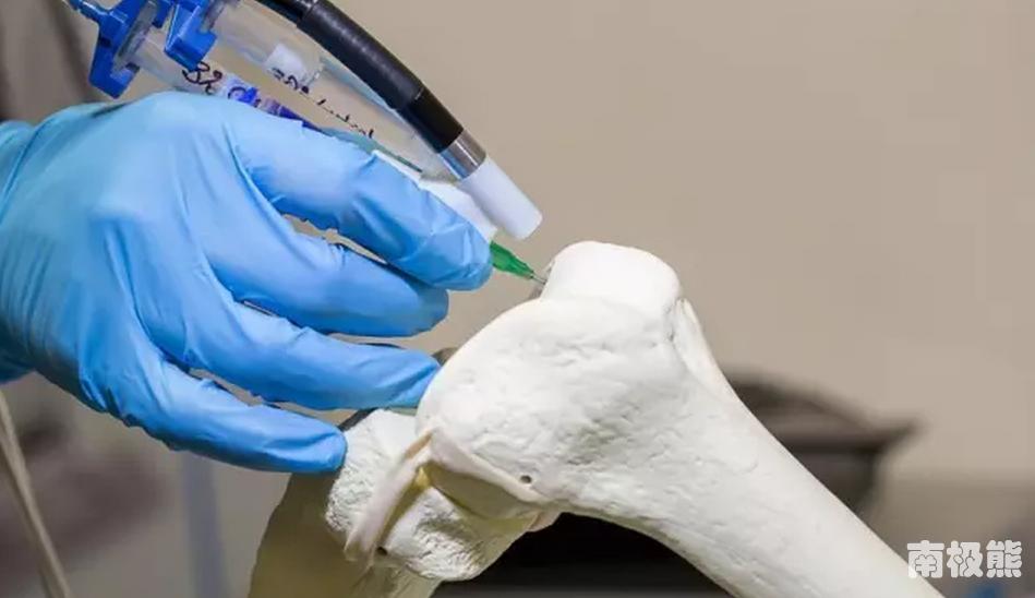 3d打印治骨折视频,3d打印治疗颌骨骨折