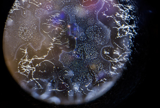 相机镜头发霉清理技巧,单反相机镜头发霉能买吗