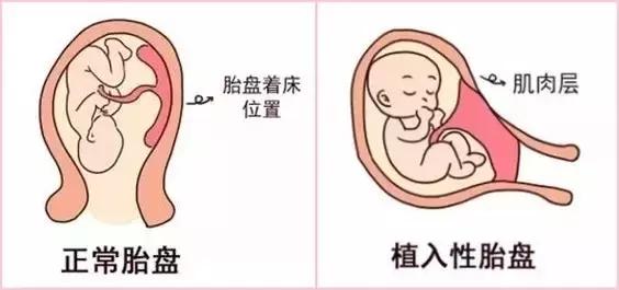 良辰吉时剖腹产,生孩子按吉时剖腹产