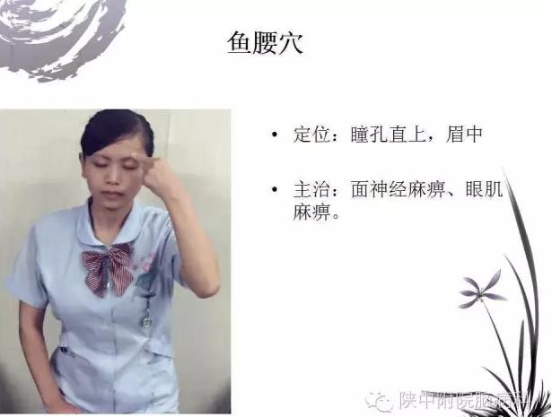 面神经炎的中医诊疗与中医护理