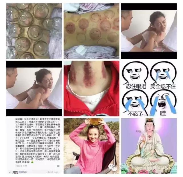 癌症去世的女演员,患癌去世的年轻女演员