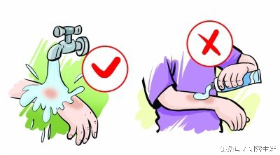 烫伤了不能干什么,烫伤一直火辣辣的疼用牙膏可以吗