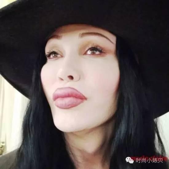 玻尿酸丰唇心得,丰唇失败了如何化妆拯救